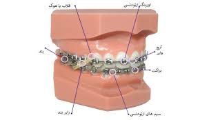 فنر ارتودنسی