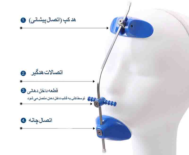 فیس ماسک ارتودنسی