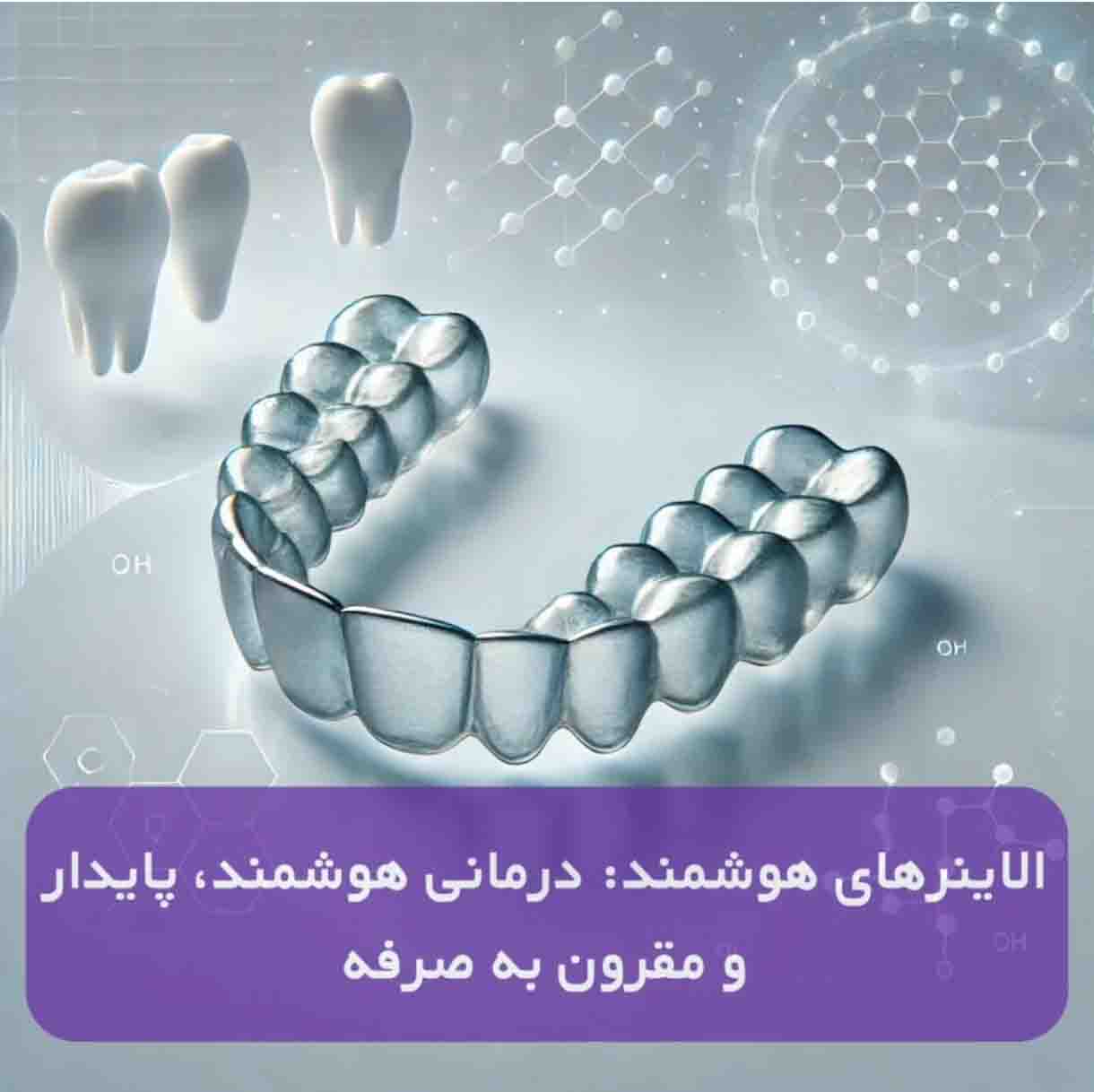 الاینر های هوشمند ارتودنسی