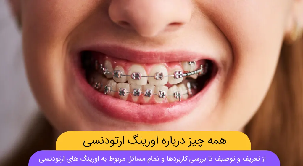 راهنمای جامع مشکلات مرتبط با اورینگ های ارتودنسی و راه حل ها