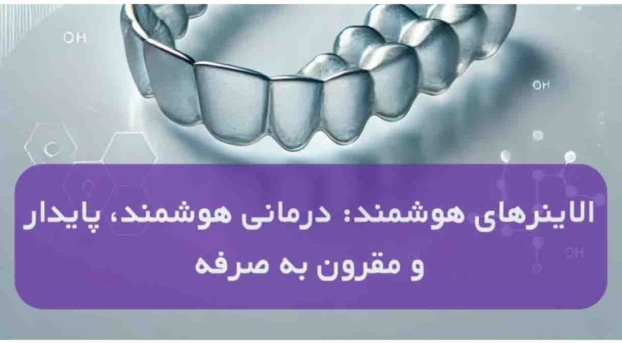 درمان ناهنجاری های دندانی با الاینر های هوشمند ارتودنسی