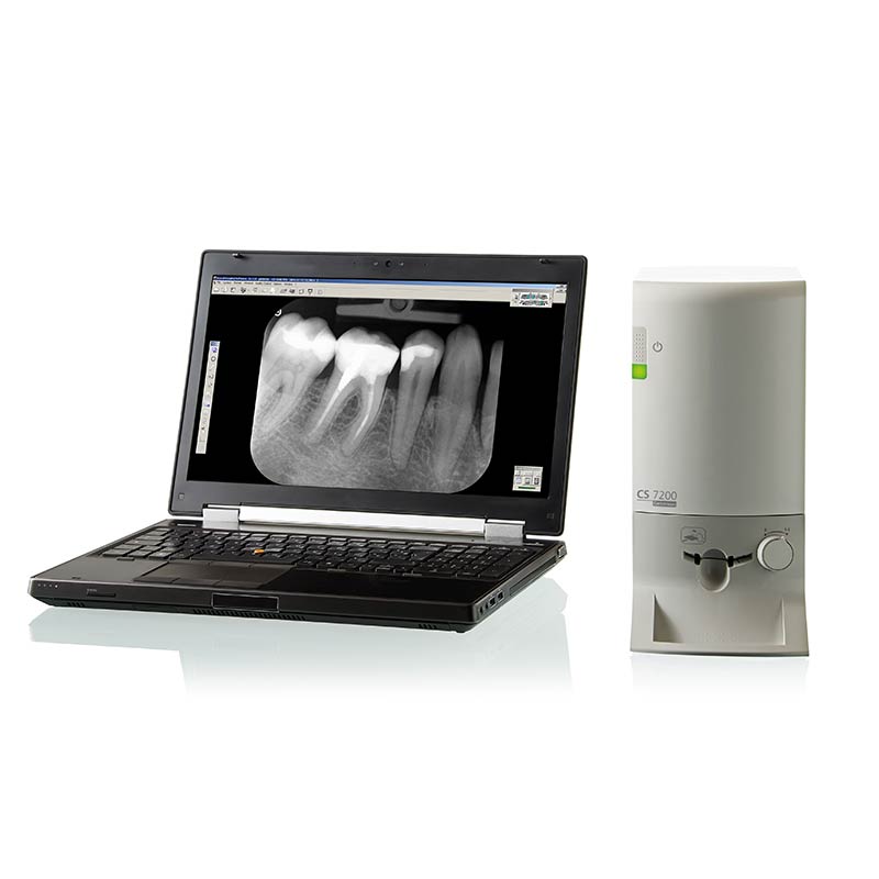 فسفرپلیت KODAK مدل CS 7200